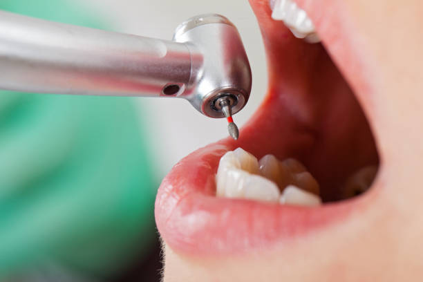 Best Emergency Root Canal Treatment in Edneyville, NC
